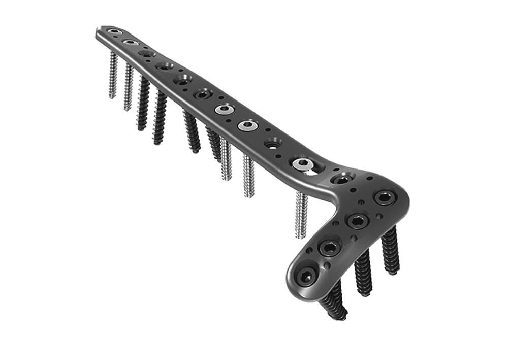 2.7mm-Cortical-Screws-~-zenith-orthocare